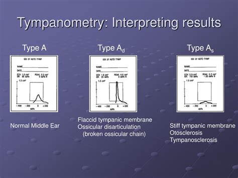 interpreting tympanogram|Tympanometry .